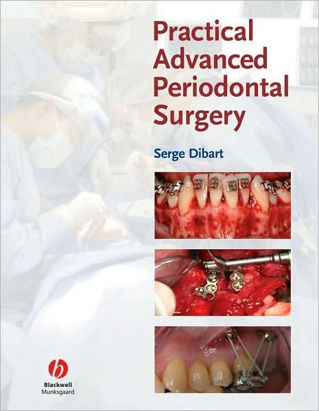 Practical Advanced Periodontal Surgery                                                                                                                <br><span class="capt-avtor"> By:                                                  </span><br><span class="capt-pari"> Eur:48,76 Мкд:2999</span>